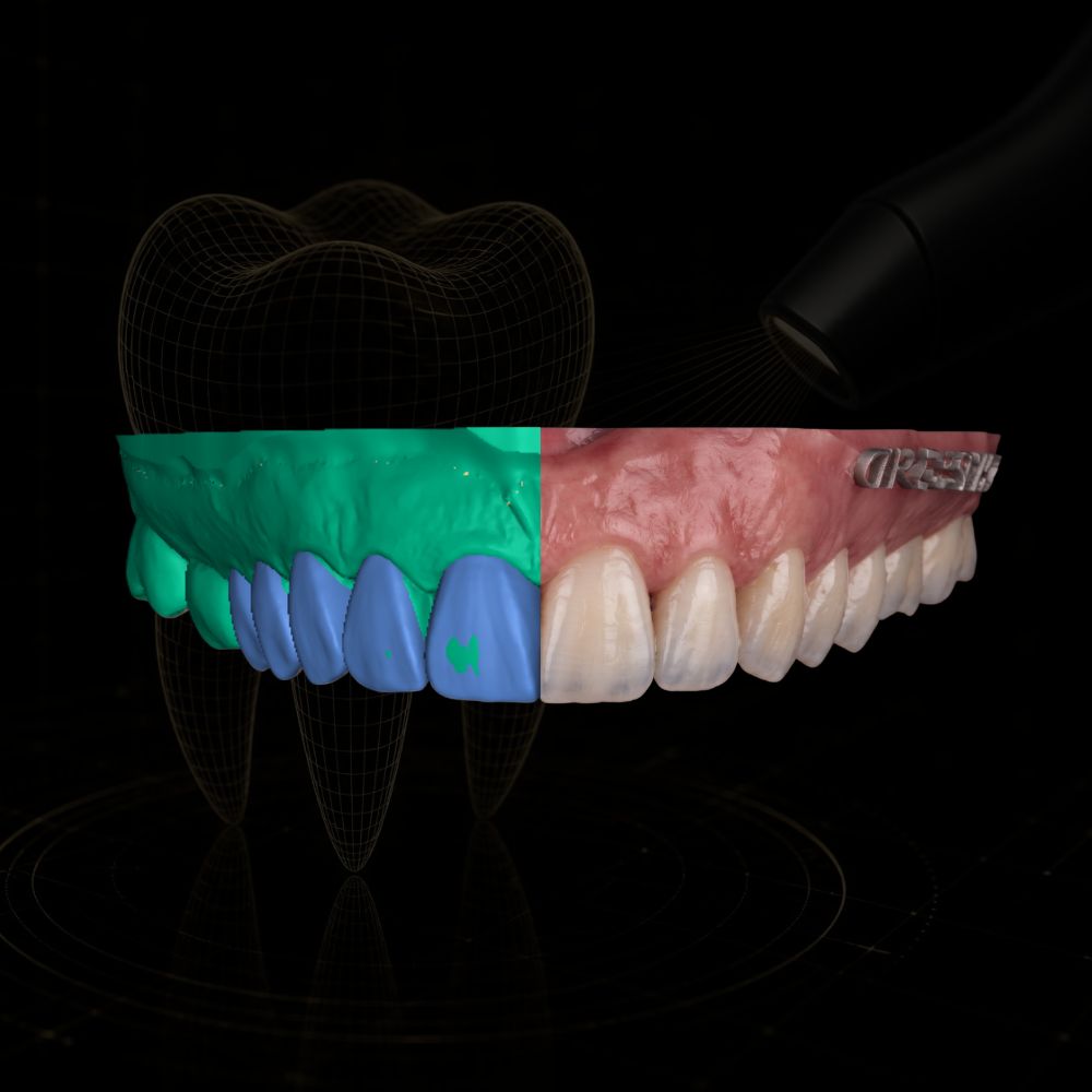 Caso de design CAD/CAM dental realizado pela Chase Cad