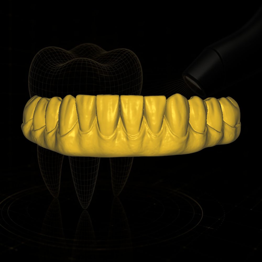 Caso de design CAD/CAM dental realizado pela Chase Cad