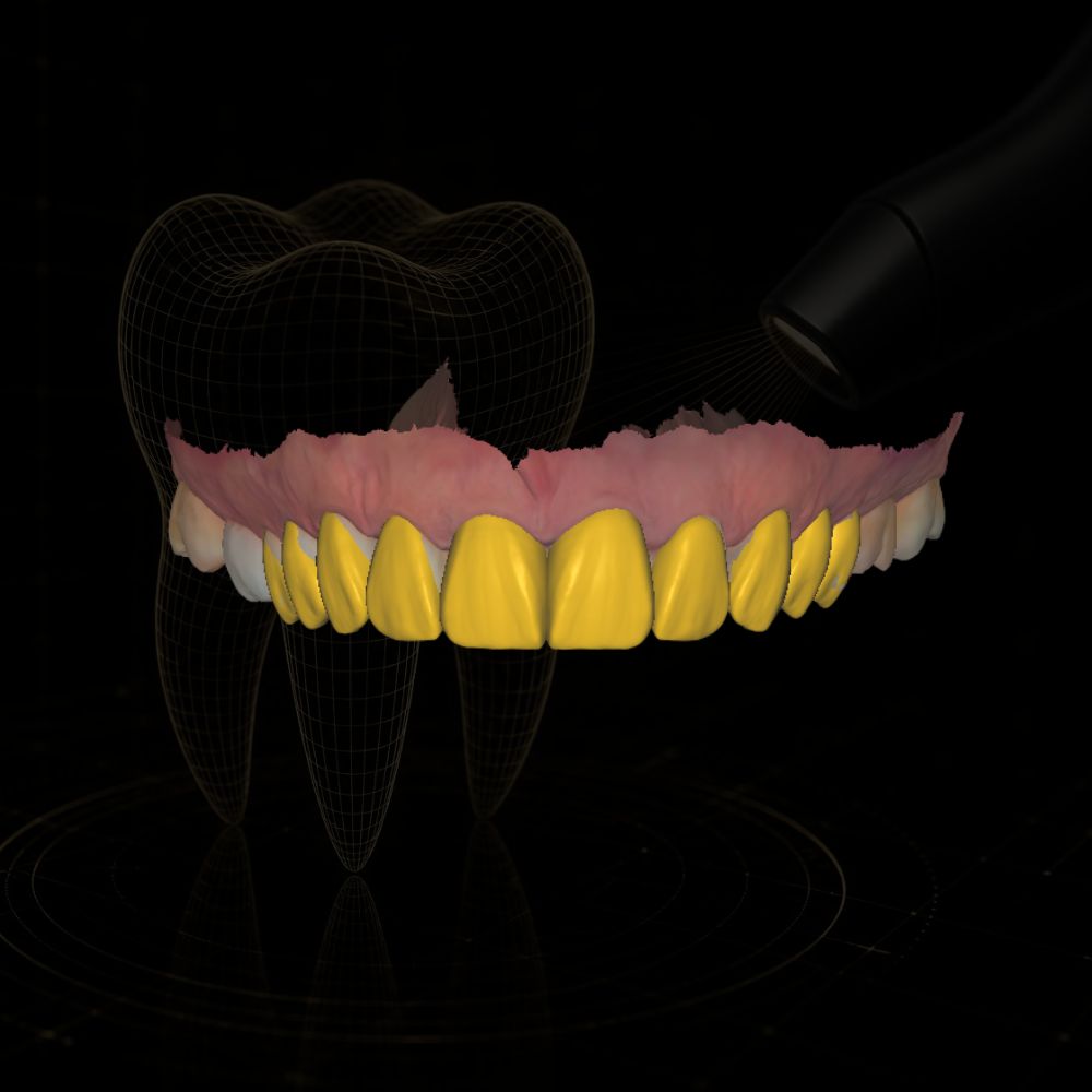 Caso de design CAD/CAM dental realizado pela Chase Cad