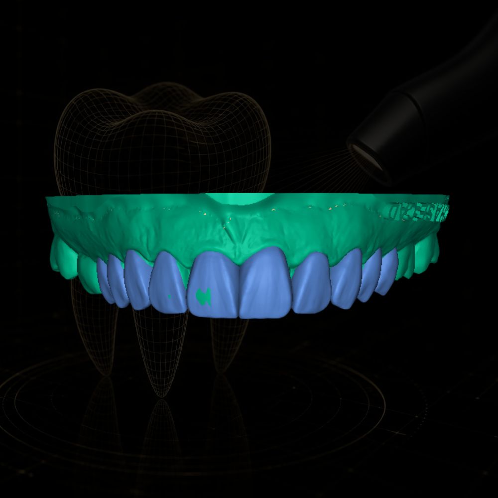 Caso de design CAD/CAM dental realizado pela Chase Cad